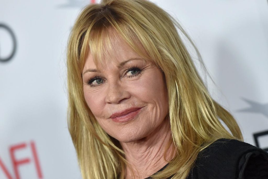 Melanie Griffith Plastic Surgery Face