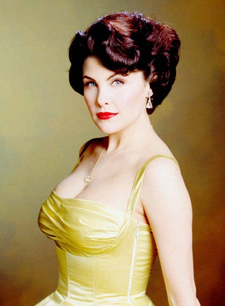 Sherilyn Fenn Cosmetic Surgery Body