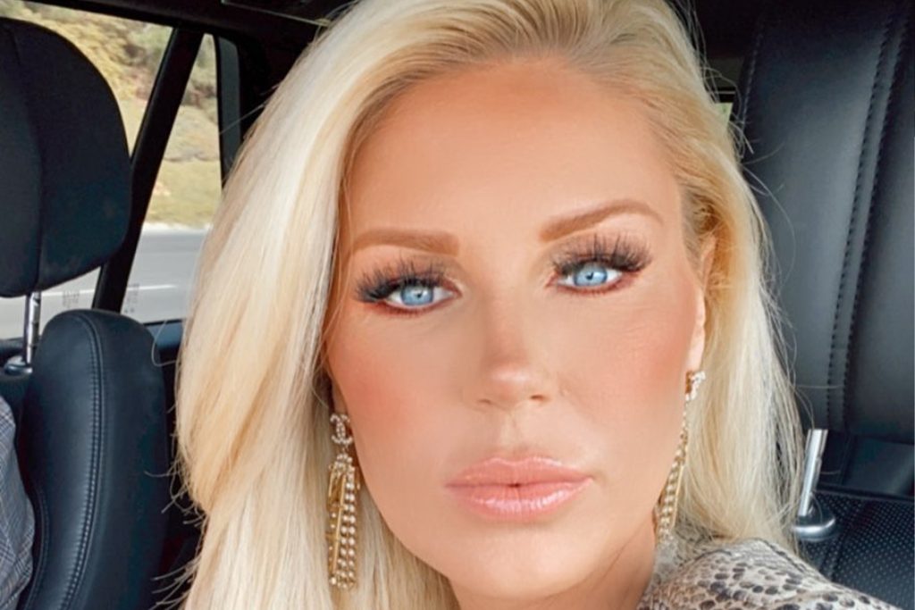 Gretchen Rossi Plastic Surgery Face