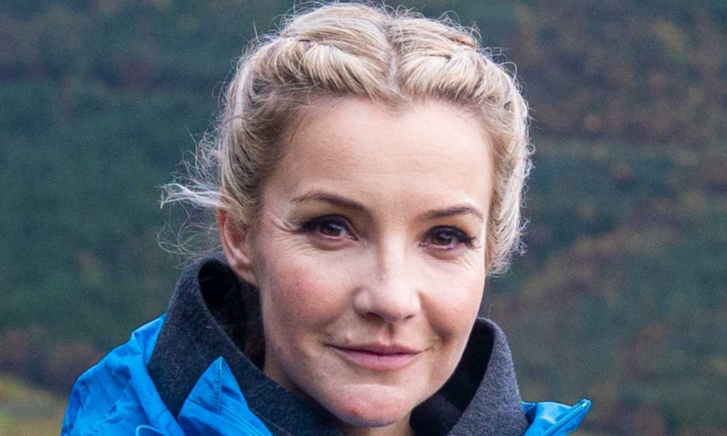 Helen Skelton Cosmetic Surgery Face