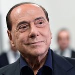 Silvio Berlusconi Cosmetic Surgery