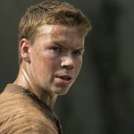 Will Poulter Cosmetic Surgery