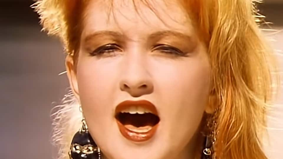 Cyndi Lauper Plastic Surgery Face