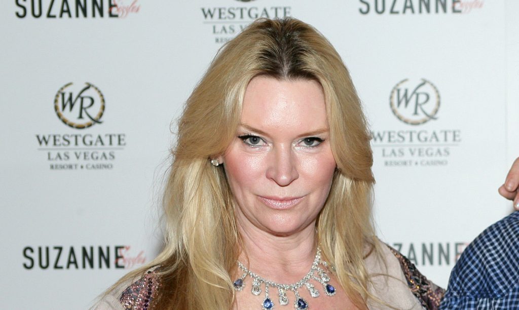 Jackie Siegel Cosmetic Surgery Face