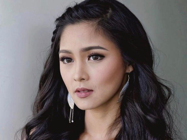 Kim Chiu Plastic Surgery Face