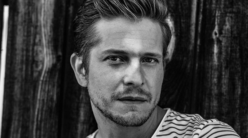 Matt Czuchry Cosmetic Surgery