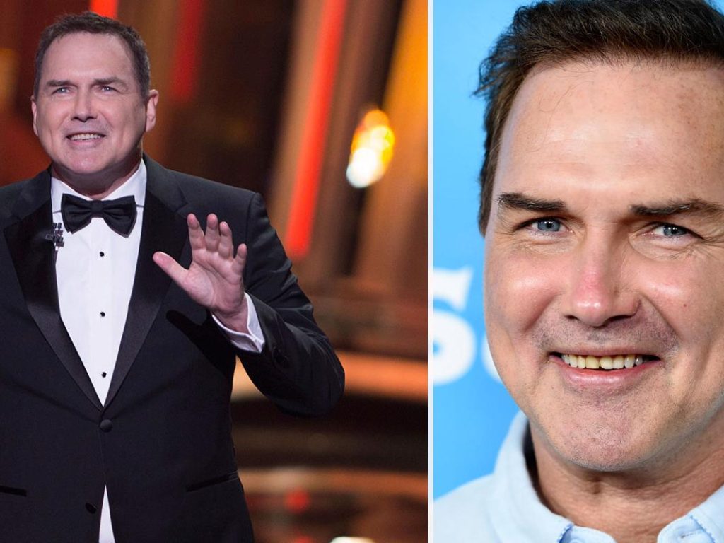 Norm Macdonald Cosmetic Surgery Face