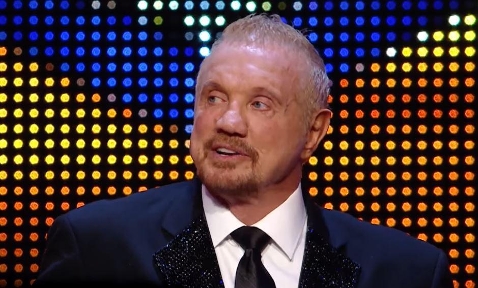 Diamond Dallas Page Cosmetic Surgery Face