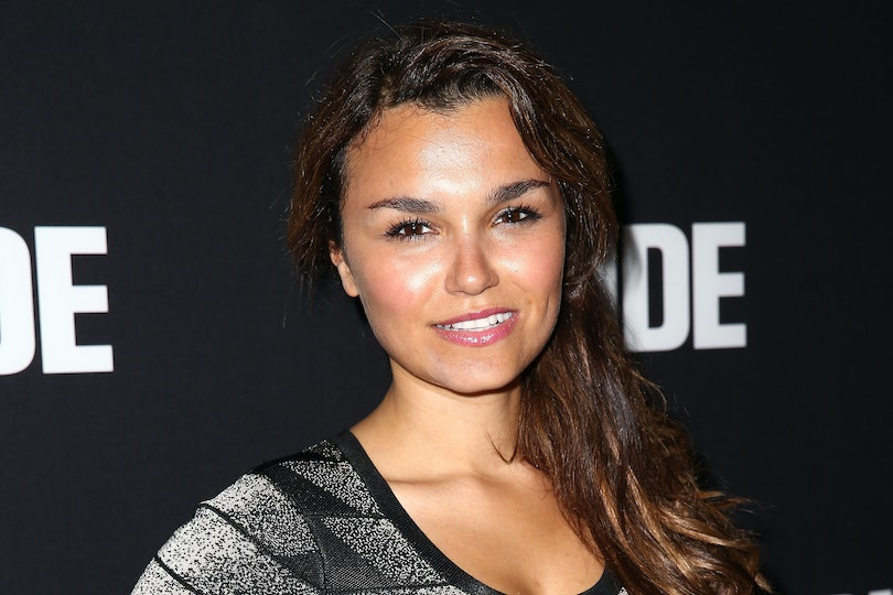 Samantha Barks Plastic Surgery Face