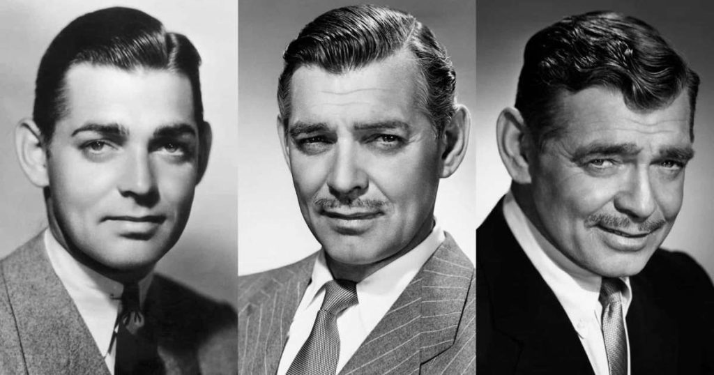 Clark Gable Plastic Surgery Face