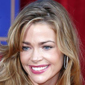 Denise Richards Cosmetic Surgery Face