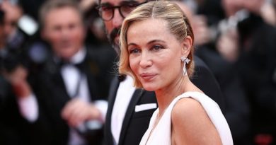 Emmanuelle Béart Plastic Surgery