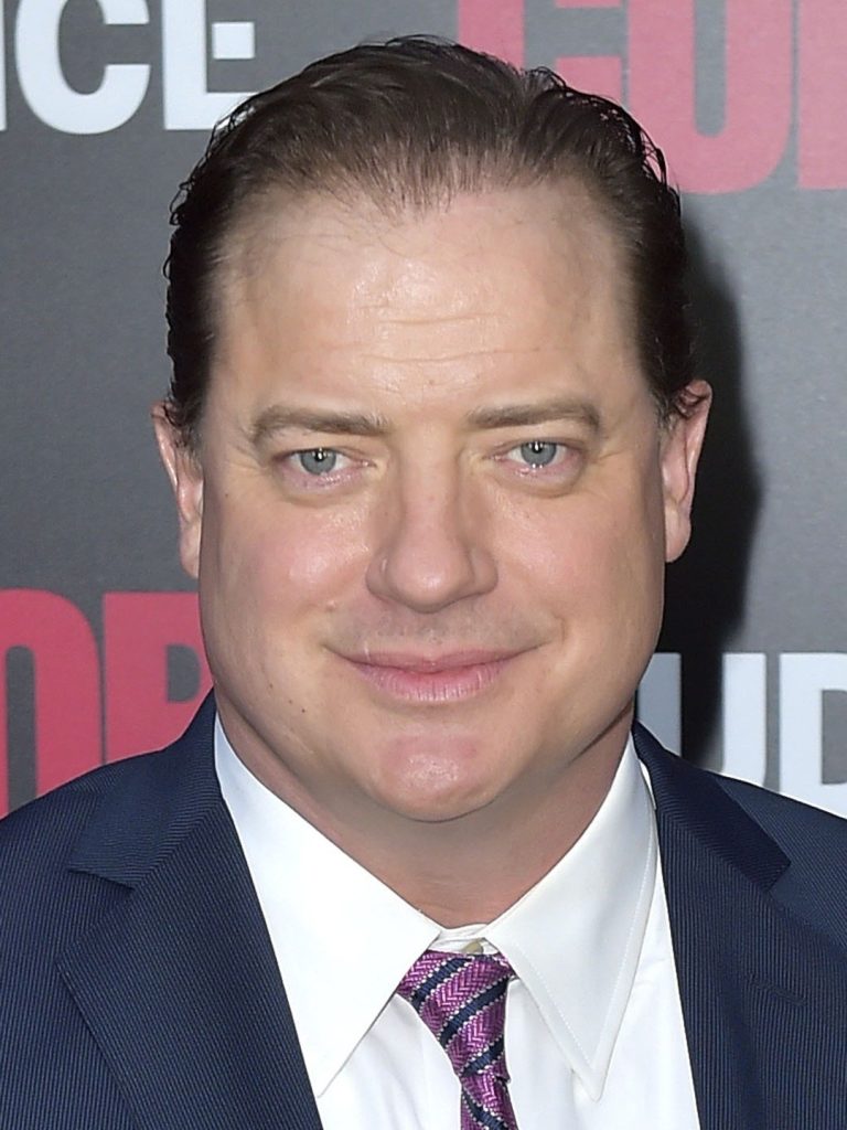 Brendan Fraser Plastic Surgery Face