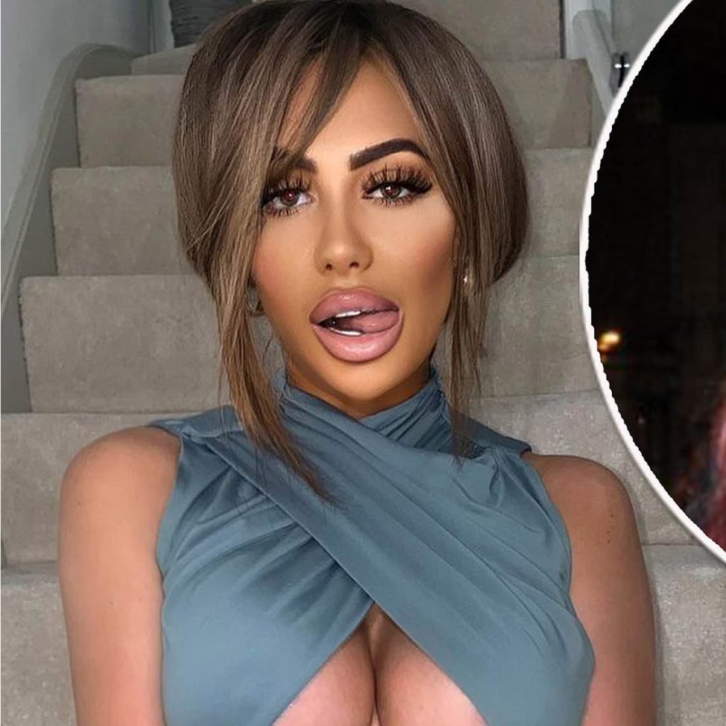 Chloe Ferry Plastic Surgery Face