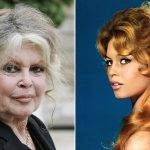 Brigitte Bardot Cosmetic Surgery