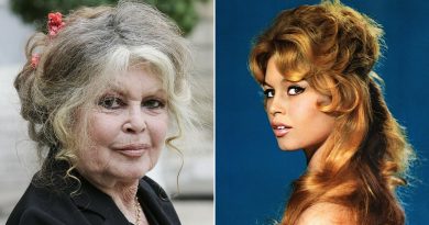 Brigitte Bardot Cosmetic Surgery