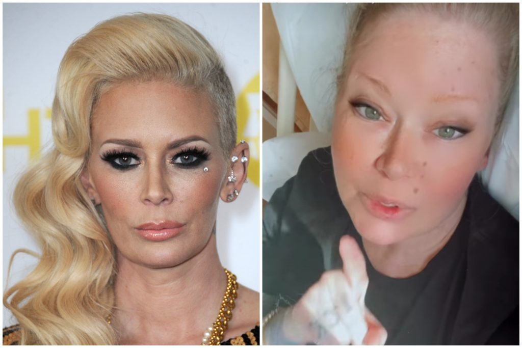 Jenna Jameson Plastic Surgery Face