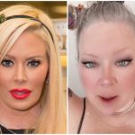 Jenna Jameson Plastic Surgery Procedures