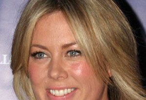 Samantha Armytage Cosmetic Surgery