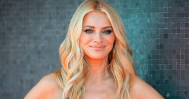 Tess Daly Cosmetic Surgery