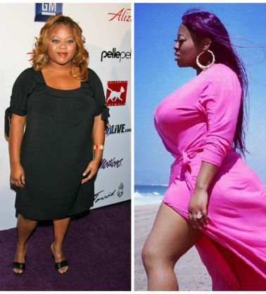 Countess Vaughn Plastic Surgery Body