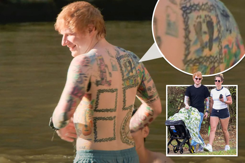 Ed Sheeran Cosmetic Surgery Body