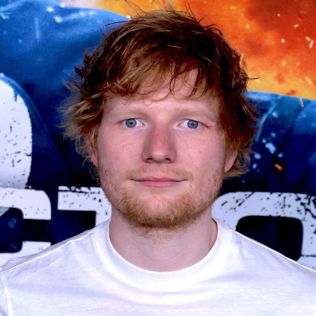 Ed Sheeran Plastic Surgery Face