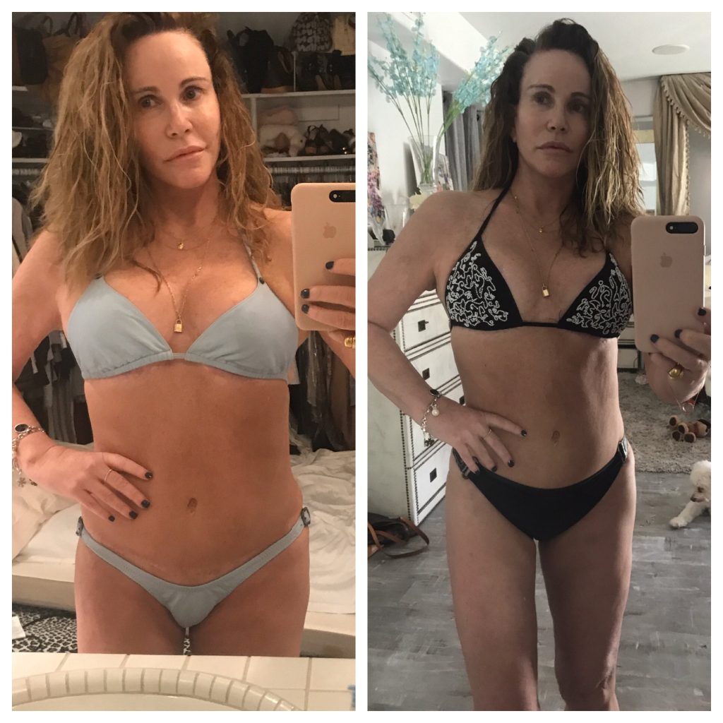 Tawny Kitaen Plastic Surgery Body