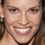 Hilary Swank Plastic Surgery