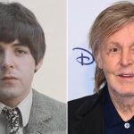 Paul McCartney Plastic Surgery Procedures