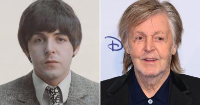 Paul McCartney Plastic Surgery Procedures