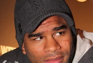 Alistair Overeem Plastic Surgery and Body Measurements