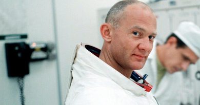 Buzz Aldrin Plastic Surgery