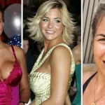 Gemma Atkinson Boob Job