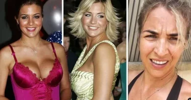 Gemma Atkinson Boob Job