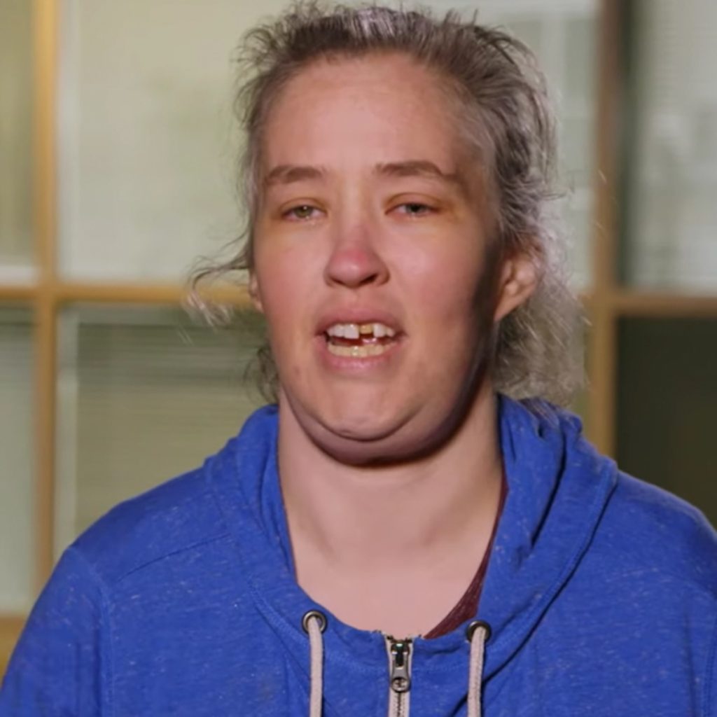 Mama June Plastic Surgery Face