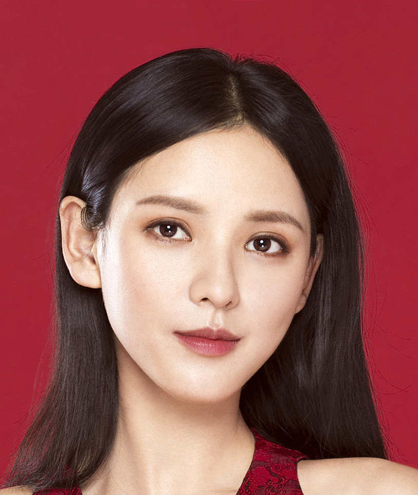 Zhang Yuxi Cosmetic Surgery Face