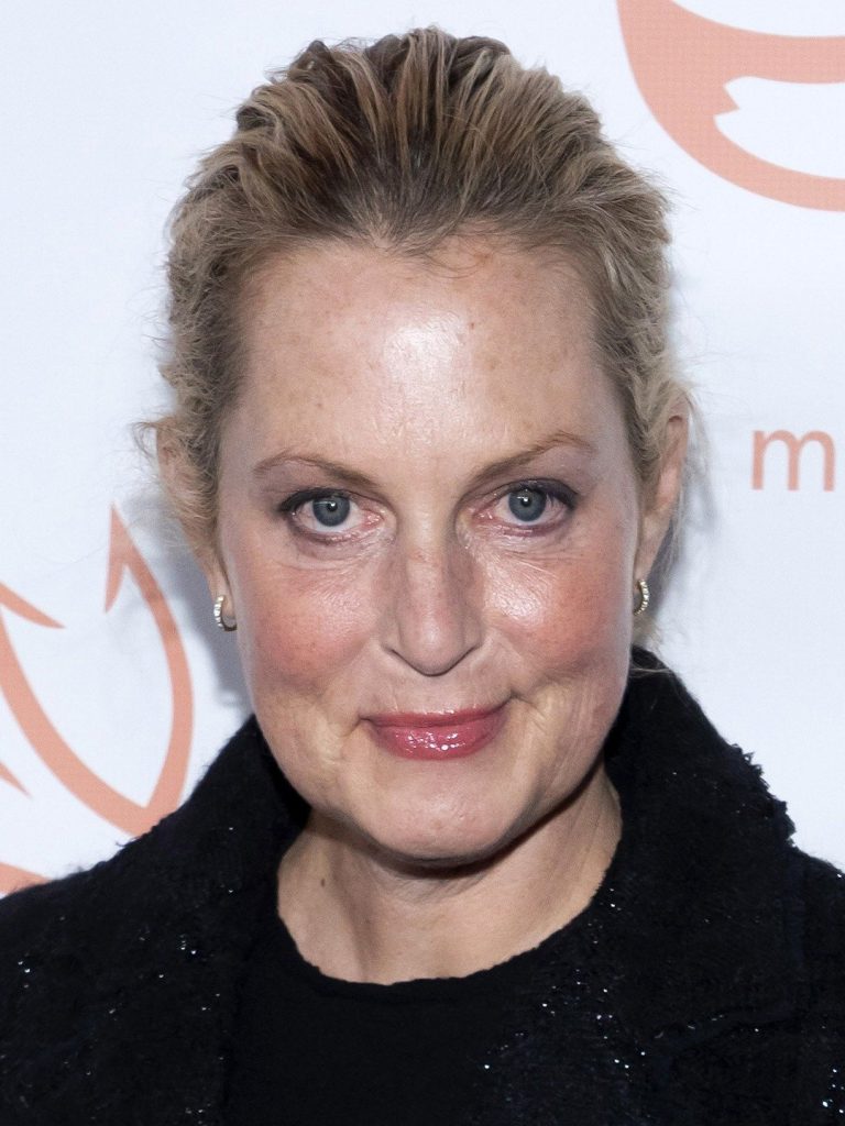 Ali Wentworth Plastic Surgery Face