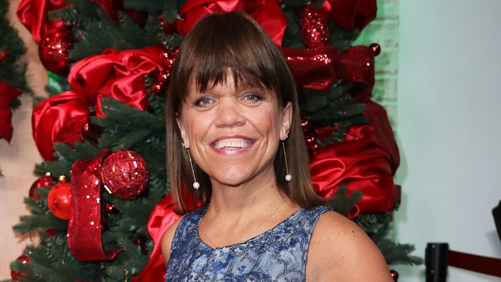 Amy Roloff Cosmetic Surgery Face