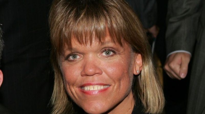 Amy Roloff Plastic Surgery and Body Measurements