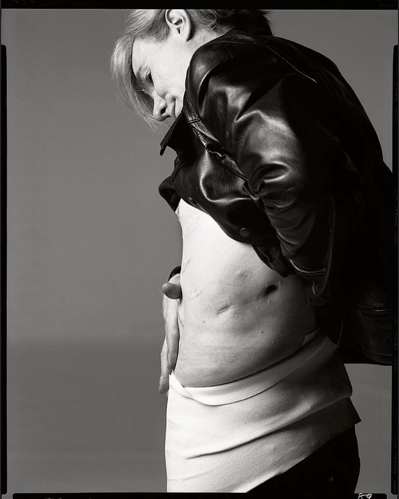Andy Warhol Plastic Surgery Body