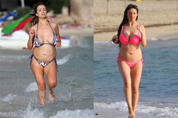 Chantelle Houghton Plastic Surgery Body