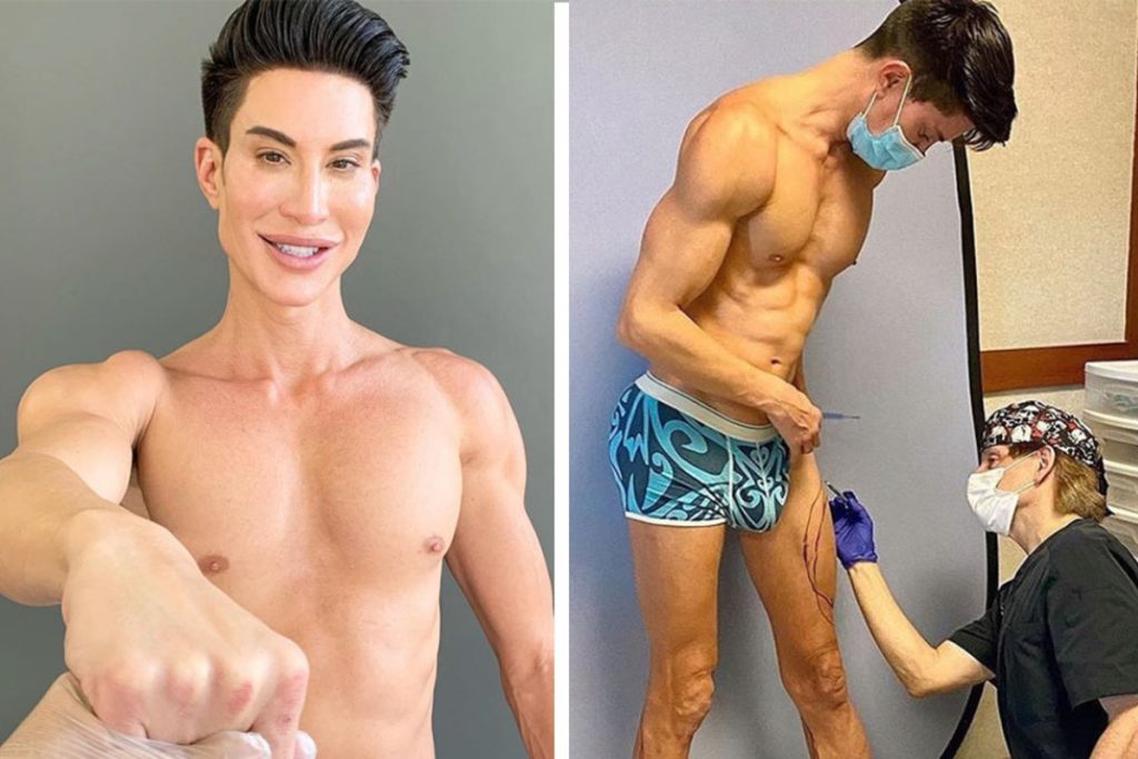 Justin Jedlica Cosmetic Surgery Body