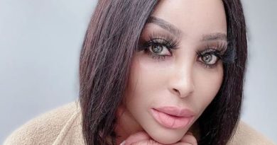 Khanyi Mbau Plastic Surgery