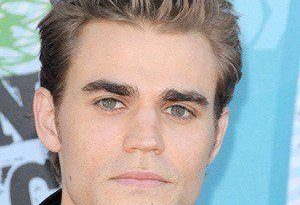 Paul Wesley Cosmetic Surgery