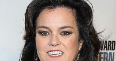 Rosie O'Donnell Cosmetic Surgery