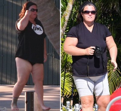 Rosie O'Donnell Plastic Surgery Body
