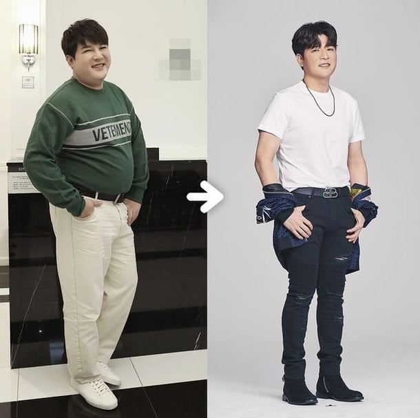 Shindong Plastic Surgery Body