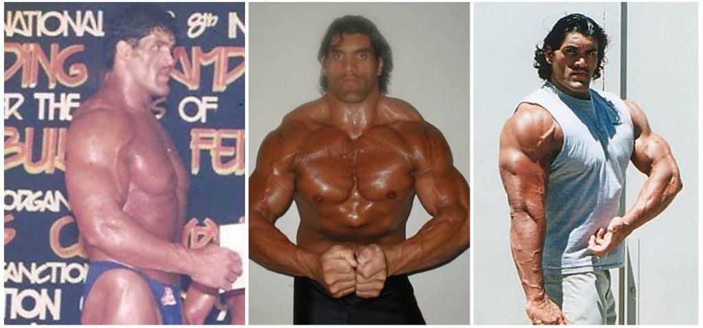 The Great Khali Plastic Surgery Body