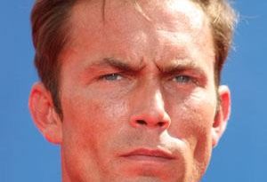 Desmond Harrington Plastic Surgery